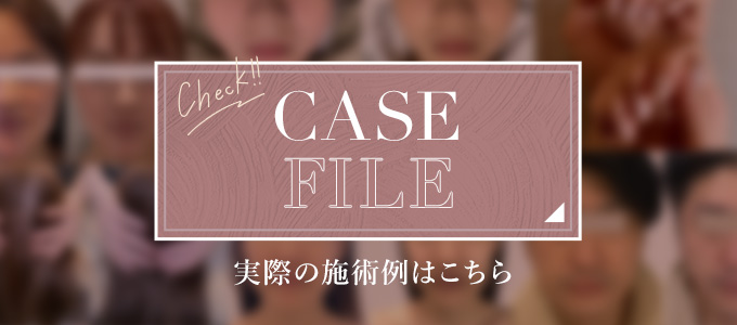 CASE FILE 実際の施術例はこちら Check!!